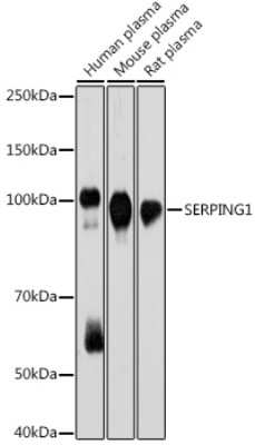 Western Blot: Serpin G1/C1 Inhibitor Antibody (0D3W8) [NBP3-15721] - Western blot analysis of extracts of various cell lines, using Serpin G1/C1 Inhibitor antibody (NBP3-15721) at 1:1000 dilution. Secondary antibody: HRP Goat Anti-Rabbit IgG (H+L) at 1:10000 dilution. Lysates/proteins: 25ug per lane. Blocking buffer: 3% nonfat dry milk in TBST. Detection: ECL Basic Kit. Exposure time: 30s.