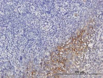 Immunohistochemistry-Paraffin: Serpin G1/C1 Inhibitor Antibody [H00000710-B01P] - Analysis of purified antibody to SERPING1 on formalin-fixed paraffin-embedded human tonsil. (antibody concentration 3 ug/ml)