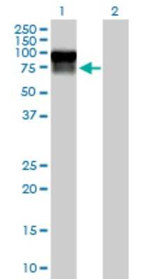 Western Blot: Serpin G1/C1 Inhibitor Antibody [H00000710-D01P] - Analysis of SERPING1 expression in transfected 293T cell line by SERPING1 polyclonal antibody.Lane 1: SERPING1 transfected lysate(55.20 KDa).Lane 2: Non-transfected lysate.