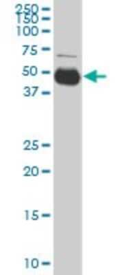 Western Blot: Serpin I1/Neuroserpin Antibody (1E10) [H00005274-M03] - Analysis of SERPINI1 expression in HeLa (Cat # L013V1).