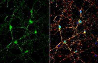 Immunocytochemistry/Immunofluorescence: Serpin I1/Neuroserpin Antibody [NBP1-31037] - Neuroserpin antibody [C3], C-term detects Neuroserpin protein by immunofluorescent analysis.Sample: DIV10 rat E18 primary cortical neuron cells were fixed in 4% paraformaldehyde at RT for 15 min.Green: Neuroserpin stained by Neuroserpin antibody [C3], C-term (NBP1-31037).Red: beta Tubulin 3/ Tuj1, stained by beta Tubulin 3/ Tuj1 antibody.Blue: Fluoroshield with DAPI.