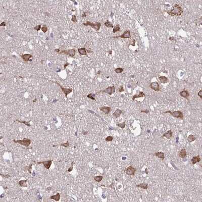 Immunohistochemistry: Serpin I1/Neuroserpin Antibody [NBP2-38784] - Staining of human cerebral cortex shows strong cytoplasmic positivity in neuronal cells.