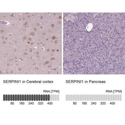 <b>Orthogonal Strategies Validation. </b>Immunohistochemistry-Paraffin: Serpin I1/Neuroserpin Antibody [NBP1-82587] - Staining in human cerebral cortex and pancreas tissues using anti-SERPINI1 antibody. Corresponding SERPINI1 RNA-seq data are presented for the same tissues.