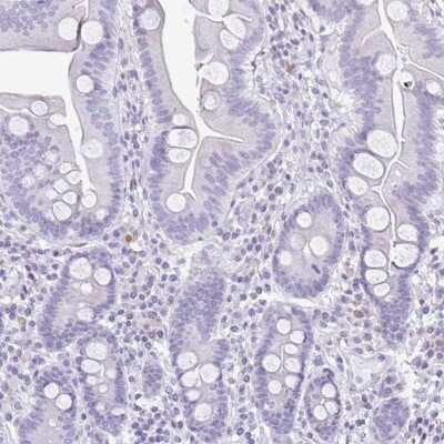 Immunohistochemistry-Paraffin: Serpin I1/Neuroserpin Antibody [NBP2-38784] - Staining of human duodenum shows low expression as expected.