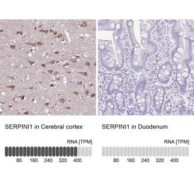 <b>Orthogonal Strategies Validation. </b>Immunohistochemistry-Paraffin: Serpin I1/Neuroserpin Antibody [NBP2-38784] - Staining in human cerebral cortex and duodenum tissues using anti-SERPINI1 antibody. Corresponding SERPINI1 RNA-seq data are presented for the same tissues.