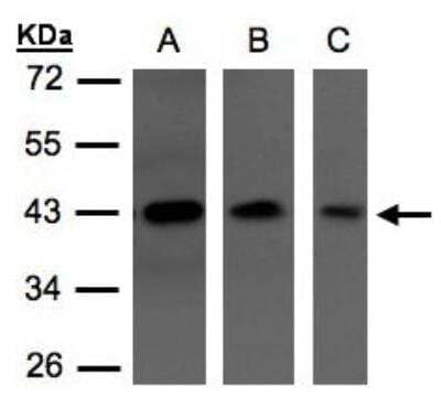 Western Blot: Serpin I1/Neuroserpin Antibody [NBP1-31037] -  Sample(30 ug of whole cell lysate)A:A431 B:HeLa S3 C:Hep G2 10% SDS PAGE, antibody diluted at 1:1500.