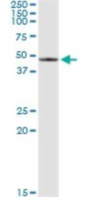 Immunoprecipitation: SerpinB2 Antibody (3A9) [H00005055-M08] - Analysis of SERPINB2 transfected lysate using anti-SERPINB2 monoclonal antibody and Protein A Magnetic Bead, and immunoblotted with SERPINB2 rabbit polyclonal antibody.