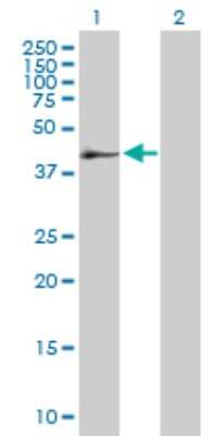 Western Blot: SerpinB2 Antibody [H00005055-B01P] - Analysis of SERPINB2 expression in transfected 293T cell line by SERPINB2 polyclonal antibody.  Lane 1: SERPINB2 transfected lysate(45.65 KDa). Lane 2: Non-transfected lysate.