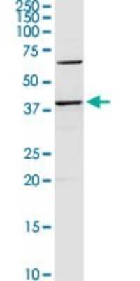 Western Blot: SerpinB2 Antibody [H00005055-D01P] - Analysis of SERPINB2 expression in mouse spleen.