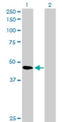 Western Blot: SerpinB2 Antibody [H00005055-D01P] - Analysis of SERPINB2 expression in transfected 293T cell line by SERPINB2 polyclonal antibody.Lane 1: SERPINB2 transfected lysate(46.60 KDa).Lane 2: Non-transfected lysate.