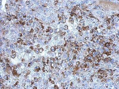 Immunohistochemistry-Paraffin: SerpinB7 Antibody [NBP2-20312] - Immunohistochemical analysis of paraffin-embedded Hela xenograft, using antibody at 1:500 dilution.