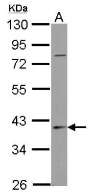 Western Blot: SerpinB7 Antibody [NBP2-20313] - Sample (30 ug of whole cell lysate) A: NT2D1 10% SDS PAGE gel, diluted at 1:1000.