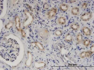 Immunohistochemistry-Paraffin: SerpinB9 Antibody (1F5) [H00005272-M06] - Analysis of monoclonal antibody to SERPINB9 on formalin-fixed paraffin-embedded human kidney. Antibody concentration 3 ug/ml