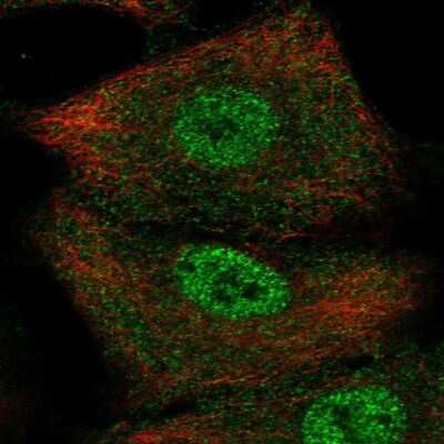 Immunocytochemistry/ Immunofluorescence SerpinB9 Antibody