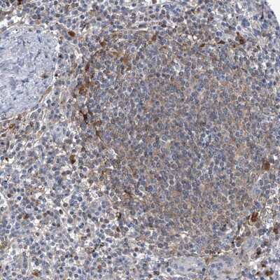 Immunohistochemistry-Paraffin: SerpinB9 Antibody [NBP2-33924] - Staining of human spleen shows moderate cytoplasmic positivity in the cells of the white pulp of spleen.