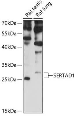Western Blot: Sertad1 Antibody [NBP2-94785] - Analysis of extracts of various cell lines, using Sertad1 . Exposure time: 30s.