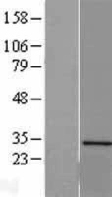 Western Blot Sertad1 Overexpression Lysate