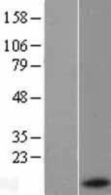 Western Blot: Serum Amyloid A Overexpression Lysate (Adult Normal) [NBL1-15670] Left-Empty vector transfected control cell lysate (HEK293 cell lysate); Right -Over-expression Lysate for Serum Amyloid A.