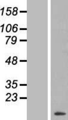 Western Blot: Serum Amyloid A Overexpression Lysate (Adult Normal) [NBL1-15671] Left-Empty vector transfected control cell lysate (HEK293 cell lysate); Right -Over-expression Lysate for Serum Amyloid A.