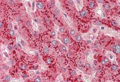 Immunohistochemistry-Paraffin: Serum Amyloid A1 Antibody [NBP3-06698] - Human Liver: Formalin-Fixed, Paraffin-Embedded (FFPE)