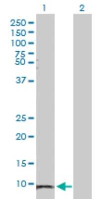 Western Blot: Serum Amyloid A1 Antibody [H00006288-D01P] - Analysis of SAA1 expression in transfected 293T cell line by SAA1 polyclonal antibody.Lane 1: SAA1 transfected lysate(13.50 KDa).Lane 2: Non-transfected lysate.