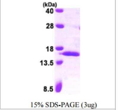 SDS-PAGE Recombinant Human Serum Amyloid A4 His Protein