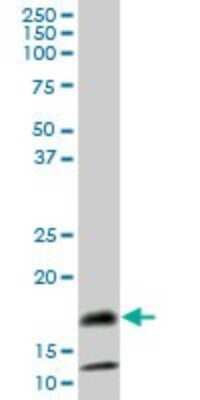Western Blot: Serum Amyloid A4 Antibody [H00006291-B02P] - Analysis of SAA4 expression in human stomach.