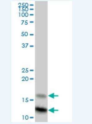 Western Blot: Serum Amyloid A4 Antibody [H00006291-B03P-50ug] - SAA4 MaxPab polyclonal antibody. Western Blot analysis of SAA4 expression in human liver.