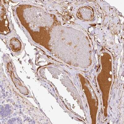 Immunohistochemistry: Serum Amyloid P Antibody [NBP2-31392] - Staining of human duodenum shows positivity in plasma.