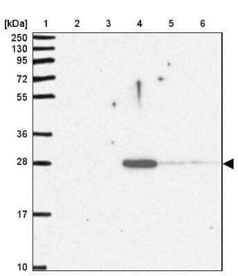 Western Blot: Serum Amyloid P Antibody [NBP2-31392] - Lane 1: Marker  [kDa] 250, 130, 95, 72, 55, 36, 28, 17, 10.  Lane 2: Human cell line RT-4.  Lane 3: Human cell line U-251MG sp.  Lane 4: Human plasma (IgG/HSA depleted).  Lane 5: Human liver tissue.  Lane 6: Human tonsil tissue