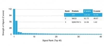 Protein Array: Serum Response Factor SRF Antibody (PCRP-SRF-1F7) - Azide and BSA Free [NBP3-14188] - Analysis of Protein Array containing more than 19,000 full-length human proteins using Serum Response Factor SRF Antibody (PCRP-SRF-1F7).