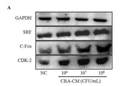 Western Blot: Serum Response Factor SRF Antibody [NBP1-33063] - Effects of CRA-CM on the expression of SRF, C-fos and CDK2 in SH-SY5Y cells. The expression levels of SRF, C-fos and CDK2 were measured by western blotting and cropped blots are displayed.  Image collected and cropped by CiteAb from the following publication (//www.nature.com/articles/s41598-017-15163-5), licensed under a CC-BY license.
