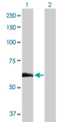 Western Blot: Seryl tRNA synthetase Antibody [H00006301-D01P] - Analysis of SARS expression in transfected 293T cell line by SARS polyclonal antibody.Lane 1: SARS transfected lysate(58.80 KDa).Lane 2: Non-transfected lysate.