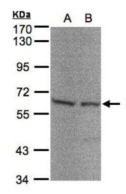 Western Blot: Seryl tRNA synthetase Antibody [NBP1-32139] - Sample (30 ug of whole cell lysate)A:293TB:A4317. 5% SDS PAGE, antibody diluted at 1:500.