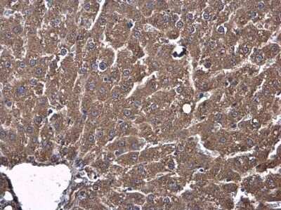 Immunohistochemistry-Paraffin: Shrew-1/AJAP1 Antibody [NBP3-13005] - Usp13 antibody detects Usp13 protein at cytoplasm in rat liver by immunohistochemical analysis. Sample: Paraffin-embedded rat liver. Usp13 antibody (NBP3-13005) diluted at 1:500. Antigen Retrieval: Citrate buffer, pH 6.0, 15 min