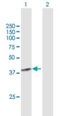 Western Blot: Shugoshin Antibody [H00151648-B01P] - Analysis of SGOL1 expression in transfected 293T cell line by SGOL1 polyclonal antibody.  Lane 1: SGOL1 transfected lysate(32.12 KDa). Lane 2: Non-transfected lysate.