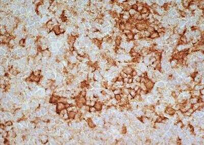 Immunohistochemistry-Frozen: Siglec-1/CD169 Antibody (ED3) [NB100-65301] - Rat lymph node cryosection with Mouse anti Rat CD169, clone ED3 followed by horseradish peroxidase conjugated Goat anti Mouse IgG2a as a detection reagent. 