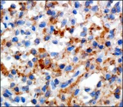 Immunohistochemistry: Siglec-1/CD169 Antibody (HSn 7D2) - Azide and BSA Free [NBP2-80947] - Staining of Sialoadhesin in human spleen using DAB with hematoxylin counterstain. Image from the standard format of this antibody.