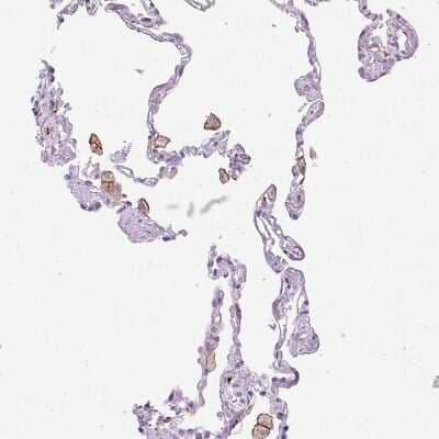 Immunohistochemistry-Paraffin: Siglec-1/CD169 Antibody [NBP2-30903] - Staining of human lung shows strong membranous positivity in macrophages.