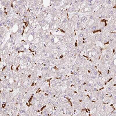 Immunohistochemistry-Paraffin: Siglec-1/CD169 Antibody [NBP2-30903] - Staining of human liver shows strong membranous positivity in Kupffer cells.