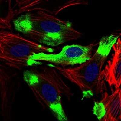 Immunocytochemistry/Immunofluorescence: Siglec-2/CD22 Antibody (1A3A11) [NBP2-37328] - Immunofluorescence analysis of Hela cells using CD22 mouse mAb (green). Blue: DRAQ5 fluorescent DNA dye. Red: Actin filaments have been labeled with Alexa Fluor-555 phalloidin.