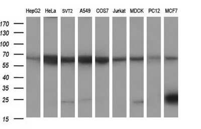 Western Blot: Siglec-2/CD22 Antibody (1F12) [NBP2-46125] - Analysis of extracts (35ug) from 9 different cell lines by using CD22 monoclonal antibody (HepG2: human; HeLa: human; SVT2: mouse; A549: human; COS7: monkey; Jurkat: human; MDCK: canine; PC12: rat; MCF7: human).