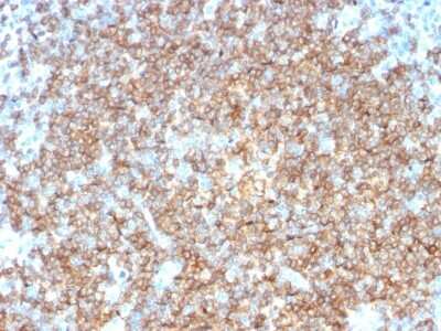 Immunohistochemistry-Paraffin: Siglec-2/CD22 Antibody (BLCAM/1795) - Azide and BSA Free [NBP2-54473] - Formalin-fixed, paraffin-embedded human Tonsil stained with CD22 Monoclonal Antibody (BLCAM/1795).