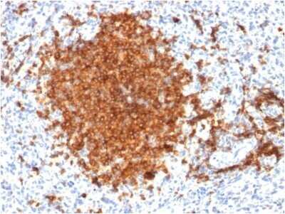 Immunohistochemistry-Paraffin: Siglec-2/CD22 Antibody (BLCAM/1795) - Azide and BSA Free [NBP2-54473] - Formalin-fixed, paraffin-embedded human Spleen stained with Siglec-2/CD22 Antibody (BLCAM/1795).