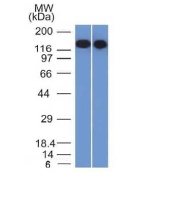 Western Blot: Siglec-2/CD22 Antibody (BLCAM/1795) - Azide and BSA Free [NBP2-54473] - Analysis of Raji and Ramos Cell Lysates using CD22 Monoclonal Antibody (BLCAM/1795).