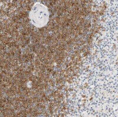 Immunohistochemistry-Paraffin: Siglec-2/CD22 Antibody [NBP1-87041] - Staining of human spleen shows strong cytoplasmic positivity in cells in white pulp.