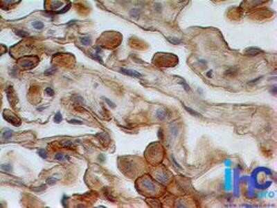 Immunohistochemistry: Siglec-3/CD33 Antibody (44M12D3) - Azide and BSA Free [NBP2-80948] - Human lung tissue stained with CD33 antibody (3 ug/ml), peroxidase-conjugate and DAB chromogen. Note cytoplasmic and membrane staining. Image from the standard format of this antibody.