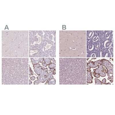 <b>Independent Antibodies Validation. </b>Immunohistochemistry-Paraffin: Siglec-6/CD327 Antibody [NBP1-85756] - Staining of human cerebral cortex, endometrium, liver and placenta using Anti-Siglec-6/CD327 antibody NBP1-85756 (A) shows similar protein distribution across tissues to independent antibody NBP1-85757 (B).