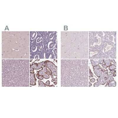 <b>Independent Antibodies Validation and Orthogonal Strategies Validation.</b>Immunohistochemistry-Paraffin: Siglec-6/CD327 Antibody [NBP1-85757] - Staining of human cerebral cortex, endometrium, liver and placenta using Anti-Siglec-6/CD327 antibody NBP1-85757 (A) shows similar protein distribution across tissues to independent antibody NBP1-85756 (B).