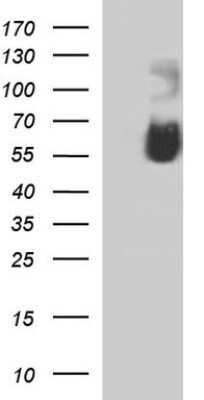 Western Blot: Siglec-7/CD328 Antibody (OTI1A1) - Azide and BSA Free [NBP2-74187] - Analysis of HEK293T cells were transfected with the pCMV6-ENTRY control (Left lane) or pCMV6-ENTRY SIGLEC-7 .